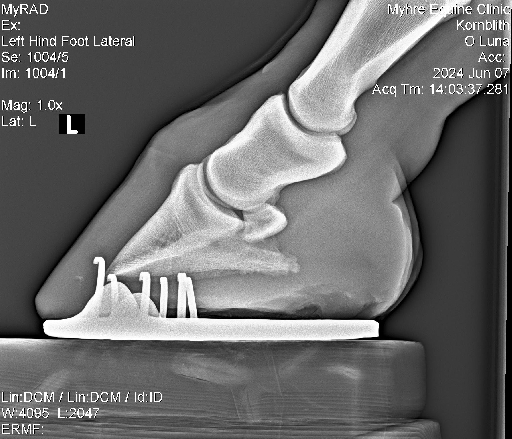 Luna Radiographs0002